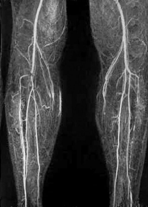 Vaskulárny X -Ray