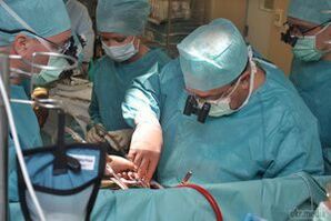 chirurgická liečba kŕčových žíl panvy