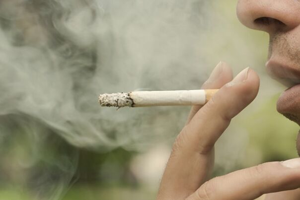 Fajčenie je jedným z dôvodov rozvoja retikulárnych kŕčových žíl